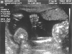 ultrasound 27 april 2004