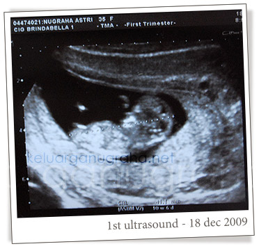 1st_ultrasound